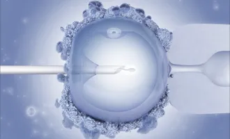 Artificial insemination procedure.