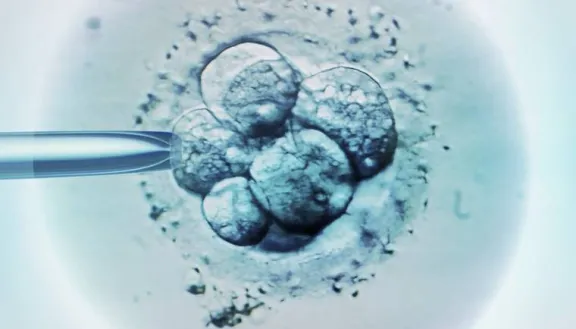Embryo cells viewed under a microscope.