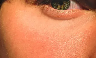 Close up of boy's face