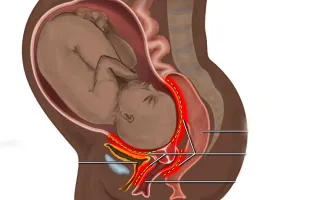 Obstetric fistula location diagram.