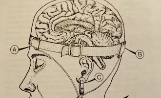 historical sketch of brain electrodes