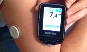 continuous glucose monitor