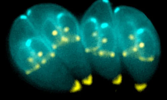 Toxoplasma gondii 