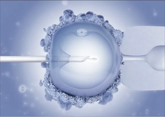 Artificial insemination procedure.