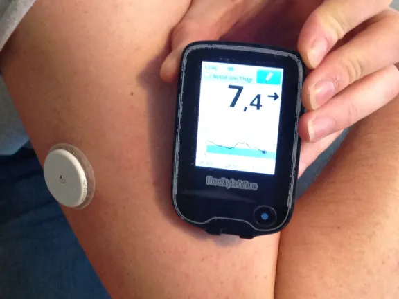 continuous glucose monitor